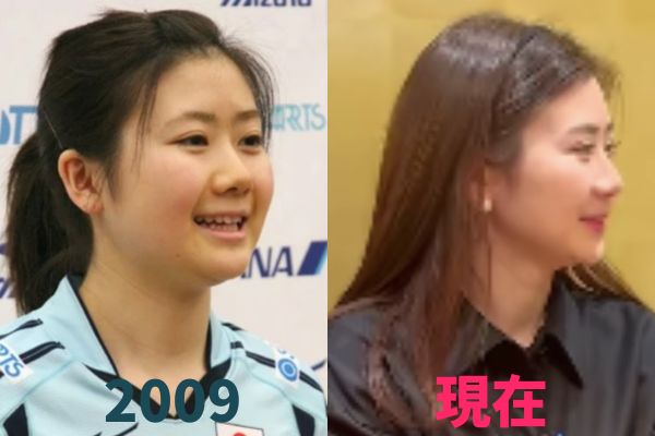 福原愛さんの鼻を昔の画像と比較