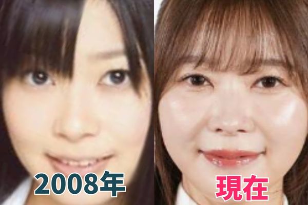 指原莉乃さんの鼻を昔の画像と比較