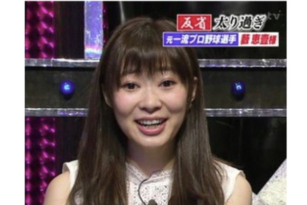 目が腫れている指原莉乃さんに「整形のダウンタイム？」の声