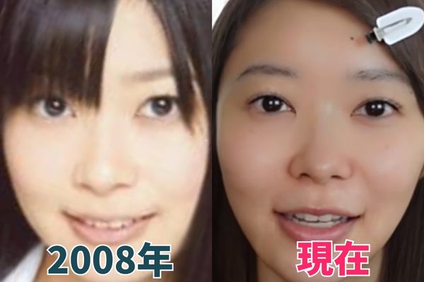 指原莉乃さんの目を昔の画像と比較