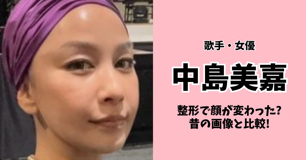 中島美嘉は整形で顔が変わった?昔の画像と比較!卒アルやすっぴん画像も調査!