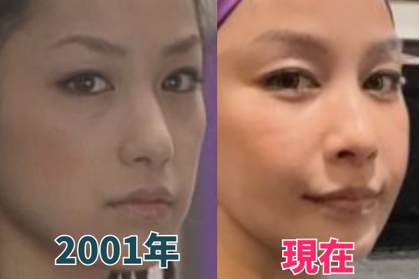 中島美嘉さんの鼻を昔の画像と比較