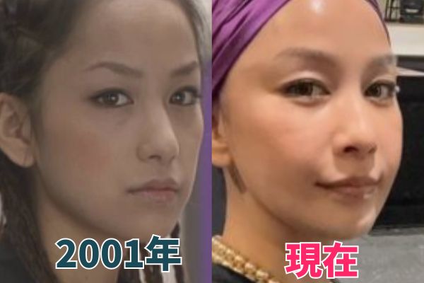 中島美嘉さんの輪郭を昔の画像と比較