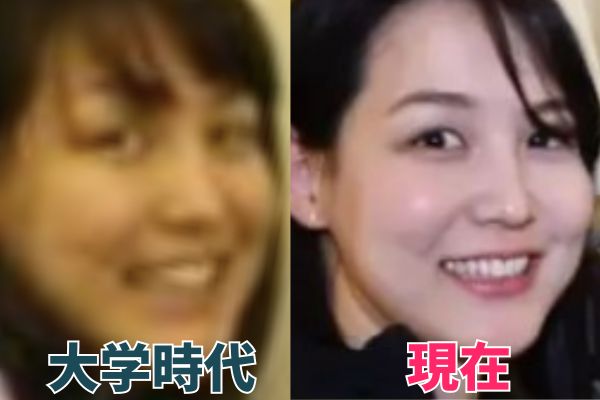 田中真美子さんの鼻を昔の画像と比較