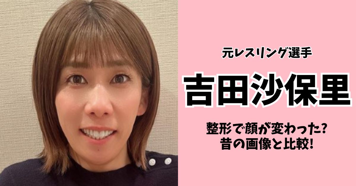 吉田沙保里は整形で顔が変わった!?昔の画像と比較!子供時代や卒アル画像も調査!