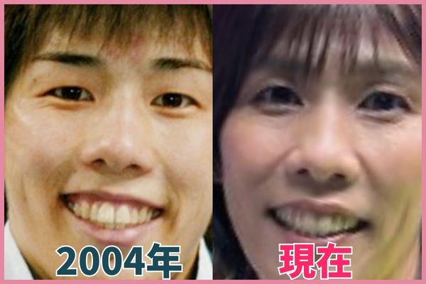 吉田沙保里さんの鼻を昔の画像と比較