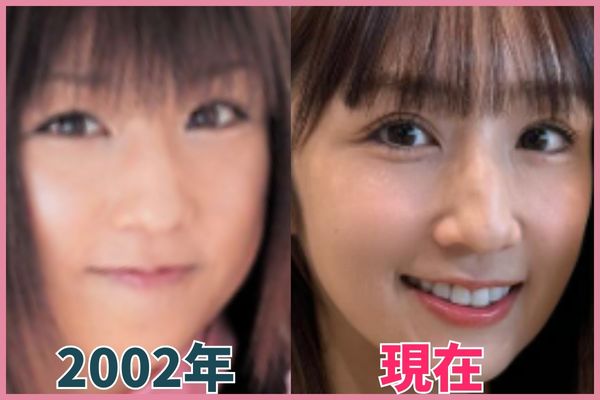 小倉優子さんの鼻を昔の画像と比較