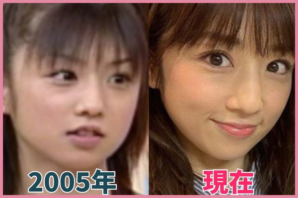 小倉優子さんの輪郭を昔の画像と比較