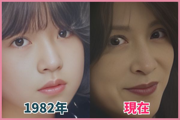 中森明菜さんの鼻を昔の画像と比較