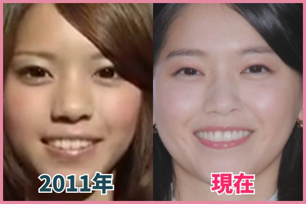 西野七瀬さんの目を昔の画像と比較