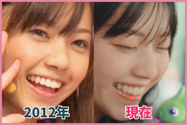 西野七瀬さんの鼻を昔の画像と比較