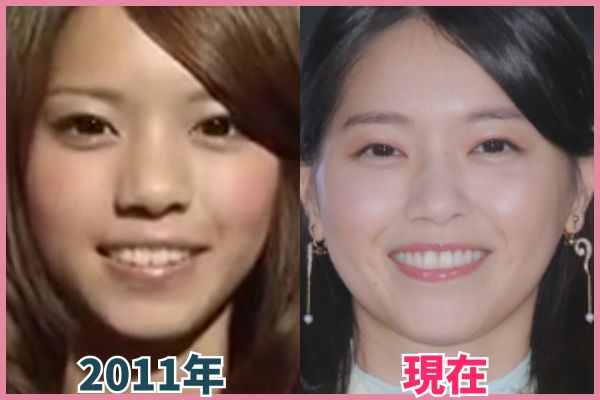 西野七瀬さんの輪郭を昔の画像と比較