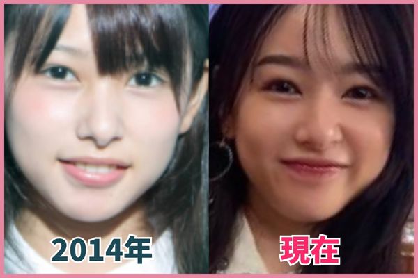 桜井日奈子さんの輪郭を昔の画像と比較