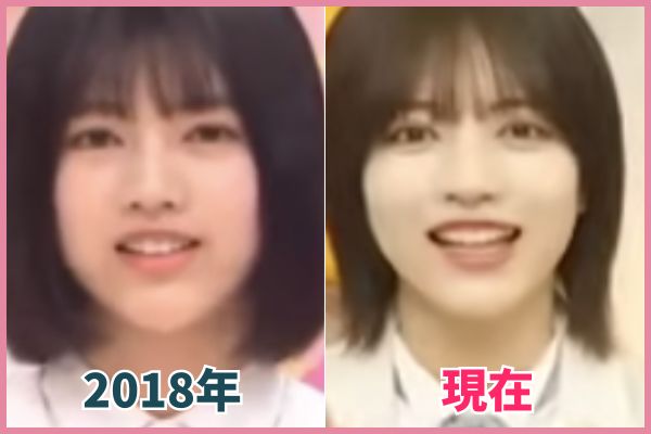 林瑠奈さんの輪郭を昔の画像と比較