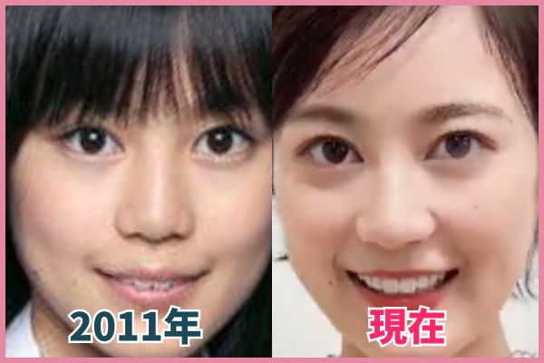 生田絵梨花さんの目を昔の画像と比較