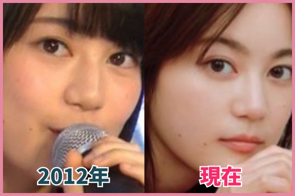 生田絵梨花さんの鼻を昔の画像と比較