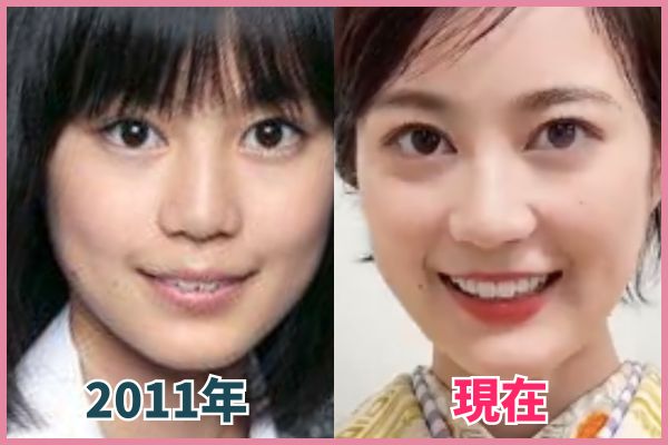 生田絵梨花さんの輪郭を昔の画像と比較