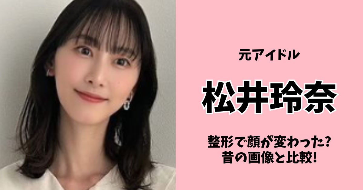 松井玲奈は整形で顔が変わった?目・鼻・輪郭を昔の画像と比較!