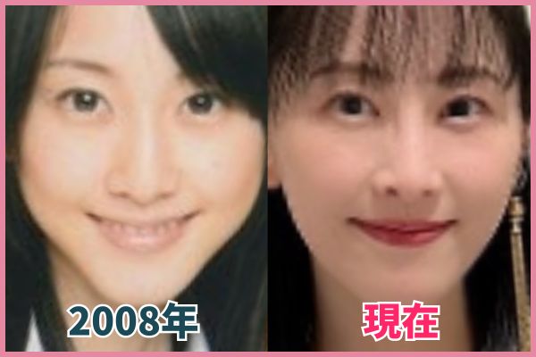 松井玲奈さんの目を昔の画像と比較