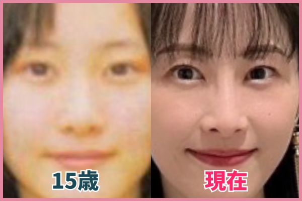 井玲奈さんの鼻を昔の画像と比較