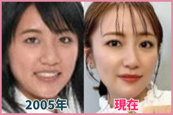 高橋みなみさんの輪郭を昔の画像と比較