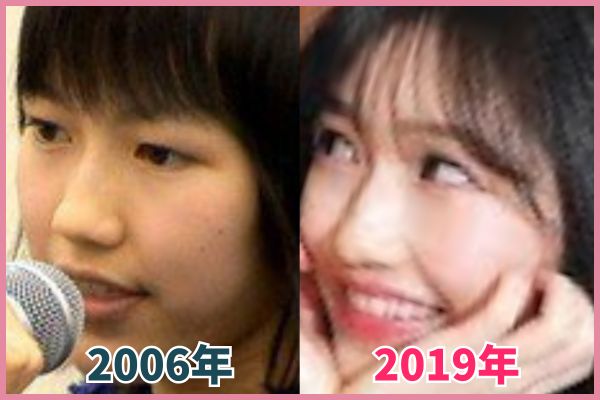 渡辺麻友さんの鼻を昔の画像と比較