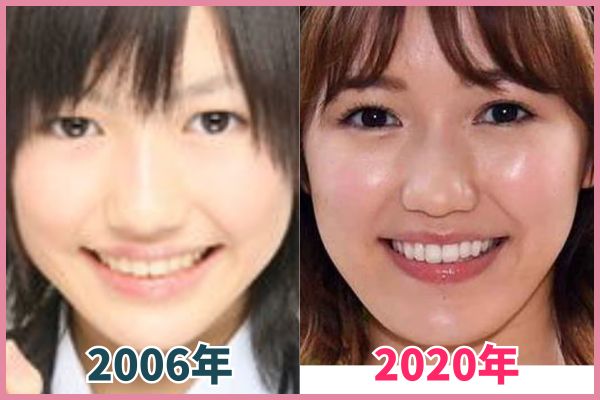 渡辺麻友さんの輪郭を昔の画像と比較し